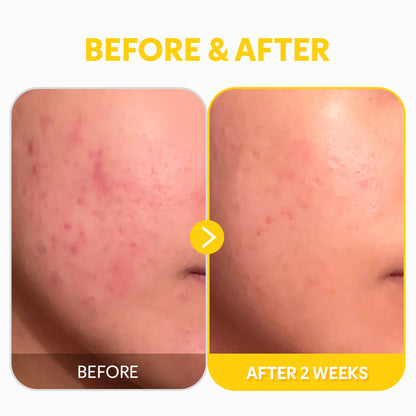 Pure Vitamin C24 Serum